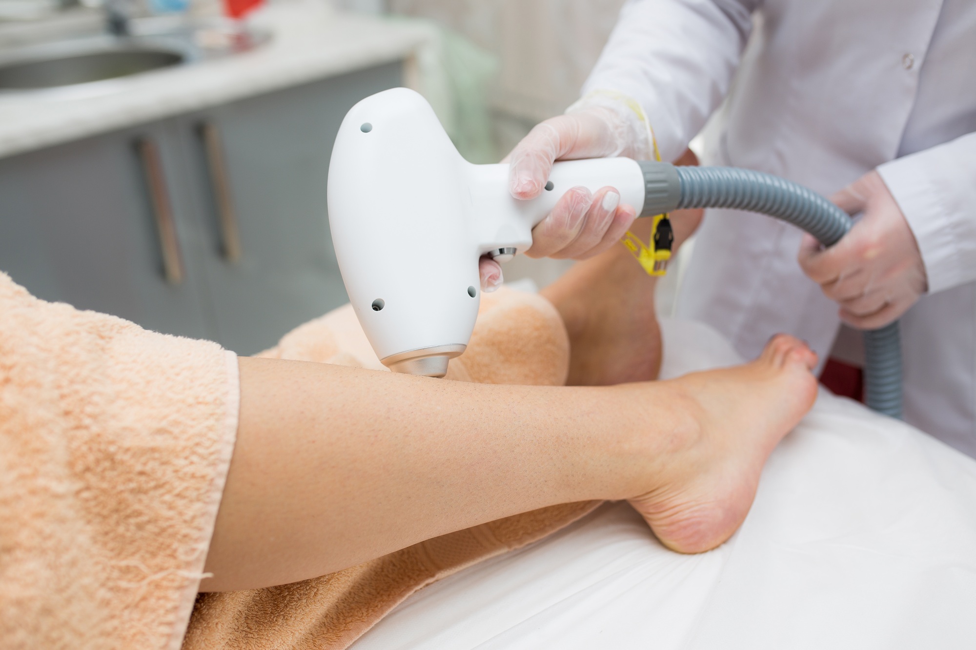 close up view of woman's leg getting laser treatment on her legs